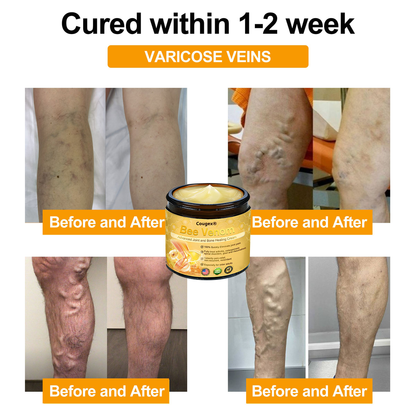 DarkFairy ® Bee Venom Advanced Joint and Bone Healing Cream