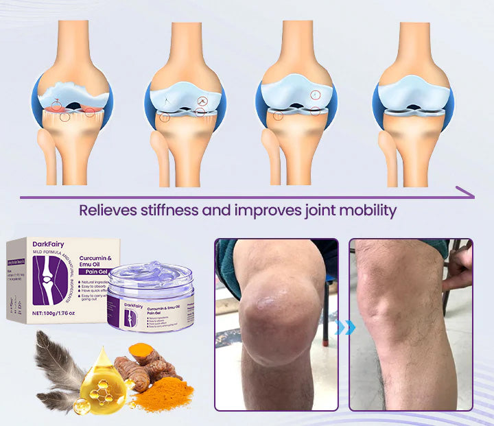 DarkFairy ®Curcumin & Emu Oil Pain Gel